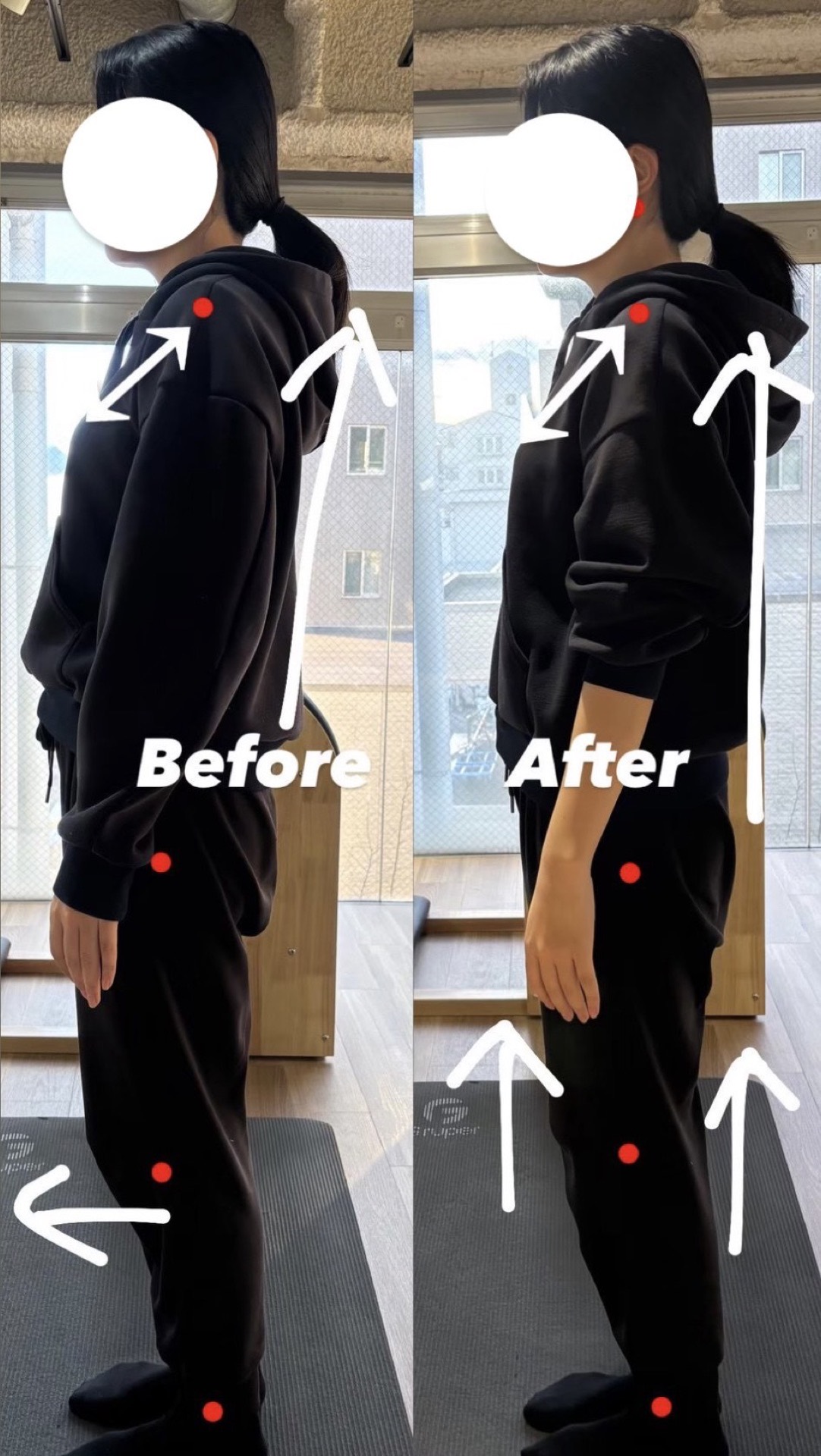 姿勢改善 Before After 1