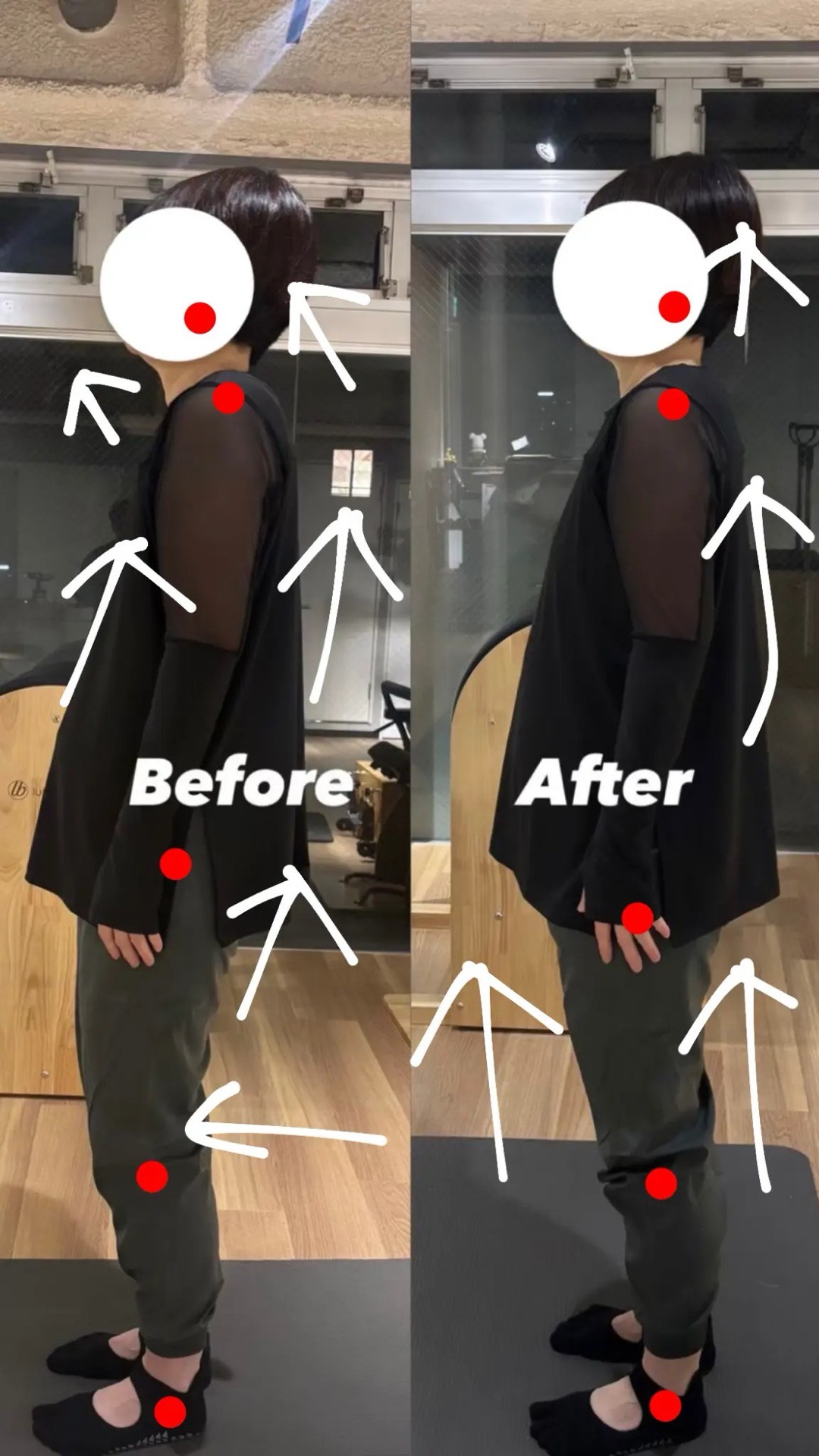 姿勢改善 Before After 2